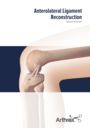 Anterolateral Ligament Reconstruction
