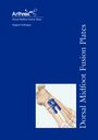 Dorsal Midfoot Fusion Plates