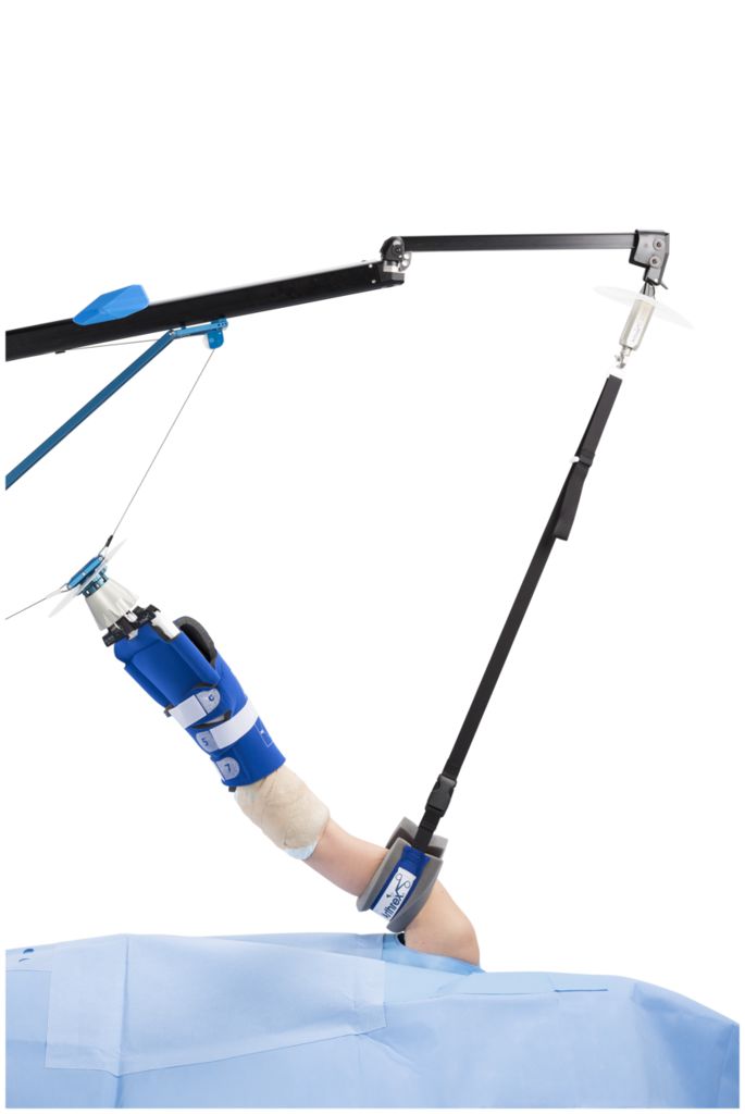 Arthrex Shoulder Suspension System (S3) (Includes Tower, US Clark