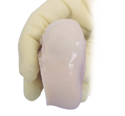arthrex cartilage allograft