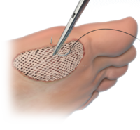 Arthrex - Helping Surgeons Treat Their Patients Better™