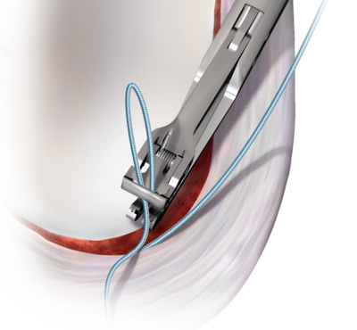 Elbow suture passers group 0 large