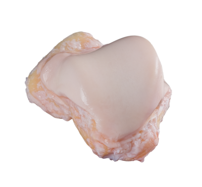 Foot and ankle cartilage allograft 0 large