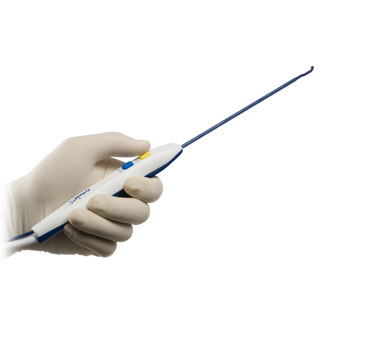 Arthrex Radio Frequency Ablation