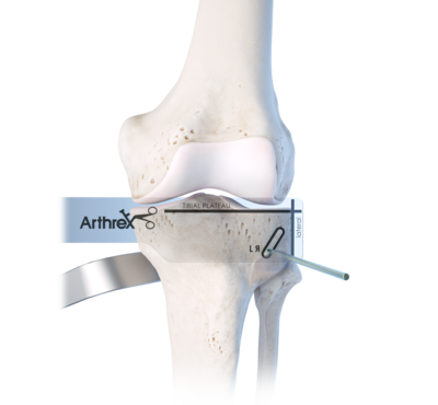 Hto hinge pin 0 large