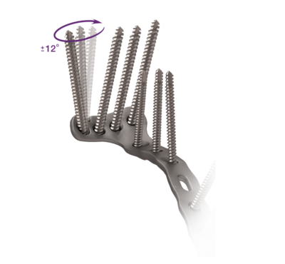 Knee peekpower tibial head fracture technique 2 large