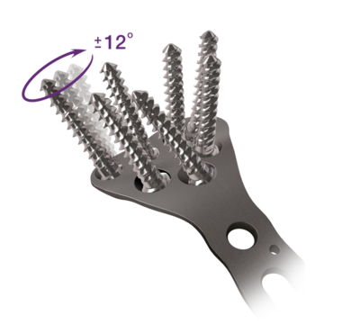 Osteosynthesis peekpower distal radius plate 1 large