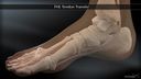 Flexor Hallucis Longus (FHL) Tendon Transfer