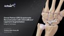 Dorsal Palmar (DP) Scapholunate Reconstruction with InternalBrace™ Ligament Augmentation