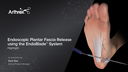 Endoscopic Plantar Fascia Release using the EndoBlade™ System