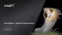 InternalBrace™ Ligament Augmentation