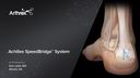 Achilles SpeedBridge™ System