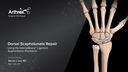Dorsal Scapholunate Repair Using InternalBrace™ Ligament Augmentation