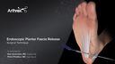 Endoscopic Plantar Fascia Release