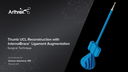 Thumb UCL Reconstruction with InternalBrace™ Ligament Augmentation