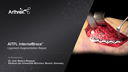 AITFL InternalBrace™ Ligament Augmentation Repair