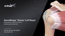 SpeedBridge™ Rotator Cuff Repair Augmented with ArthroFlex®  Decellularized Dermis