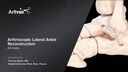 Arthroscopic Lateral Ankle Reconstruction - All-Inside