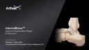 InternalBrace™ Ligament Augmentation Repair in Conjunction with Open Brostrom Surgical Technique