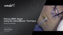 Primary MPFL Repair with InternalBrace™ Ligament Augmentation