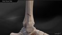 Distal Fibular Plate