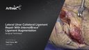 Lateral Ulnar Collateral Ligament Repair With InternalBrace™ Ligament Augmentation