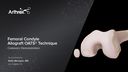 Femoral Condyle Allograft OATS® Technique