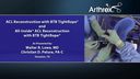 ACL Reconstruction with BTB TightRope® and All-Inside® ACL Reconstruction with BTB TightRope®