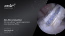ACL Reconstruction With InternalBrace™ Ligament Augmentation Using Quadriceps Tendon