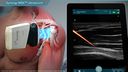 Synergy MSK™ Ultrasound
