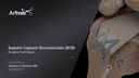 Superior Capsular Reconstruction (SCR)