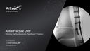 Ankle Fracture ORIF Utilizing the Syndesmosis TightRope® Fixation