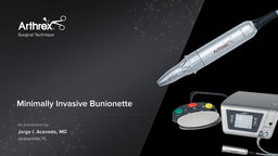 SYt5TPks 0aWiwFl5 O18g 0 256