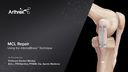 MCL Repair with InternalBrace™ Ligament Augmentation
