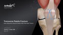 Transverse Patella Fracture Open Reduction Internal Fixation With FiberTape® Suture