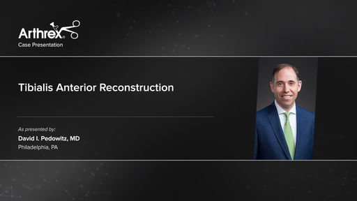 X2oDo LoIUqdsgFsv kkAQ 0 512