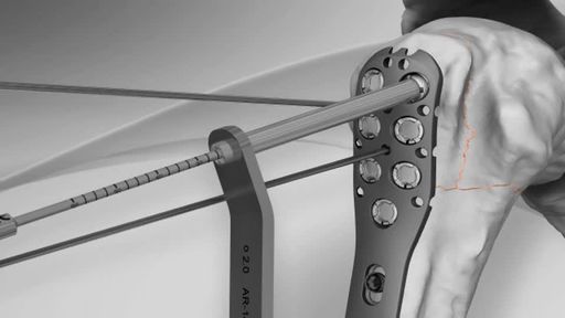 A0ZvLs2AV0avWgE7ZgqgFg 0