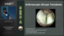 Proximal Biceps Tenodesis