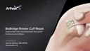 BioBridge® Rotator Cuff Repair Augmented with DX Reinforcement Matrix