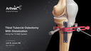 Tibial Tubercle Osteotomy With Distalization Using the T3 AMZ System