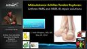 Arthrex Foot and Ankle Innovation for Sports Surgeons: Achilles Rupture
