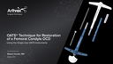 OATS® Technique for Restoration of a Femoral Condyle OCD Using the Single-Use OATS Instruments