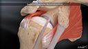 Superior Capsular Reconstruction