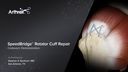 SpeedBridge™ Rotator Cuff Repair Cadaveric Demonstration
