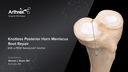 Knotless Posterior Horn Meniscus Root Repair With a PEEK SwiveLock® Anchor