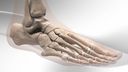 Flatfoot Repair with InternalBrace™ Ligament Augmentation