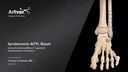 Syndesmosis AITFL Ligament Repair Using InternalBrace™ Ligament Augmentation