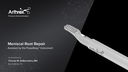 Meniscal Root Repair Assisted by the PoweRasp™ Instrument