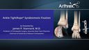 Ankle TightRope® Syndesmosis Fixation