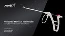 Horizontal Meniscal Tear Repair Using the Knee Scorpion™ Suture Passer